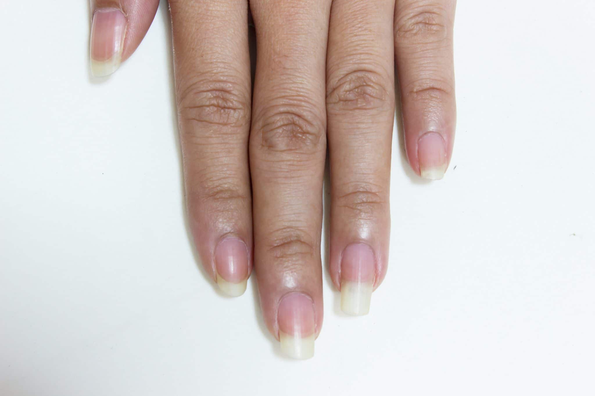 Tips for Strong and Healthy Nails IONIA AZURÉ AG